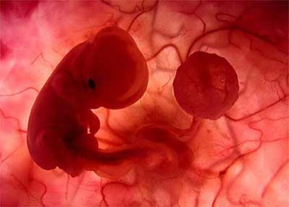 ana rahminde bir kaç haftalık embriyo